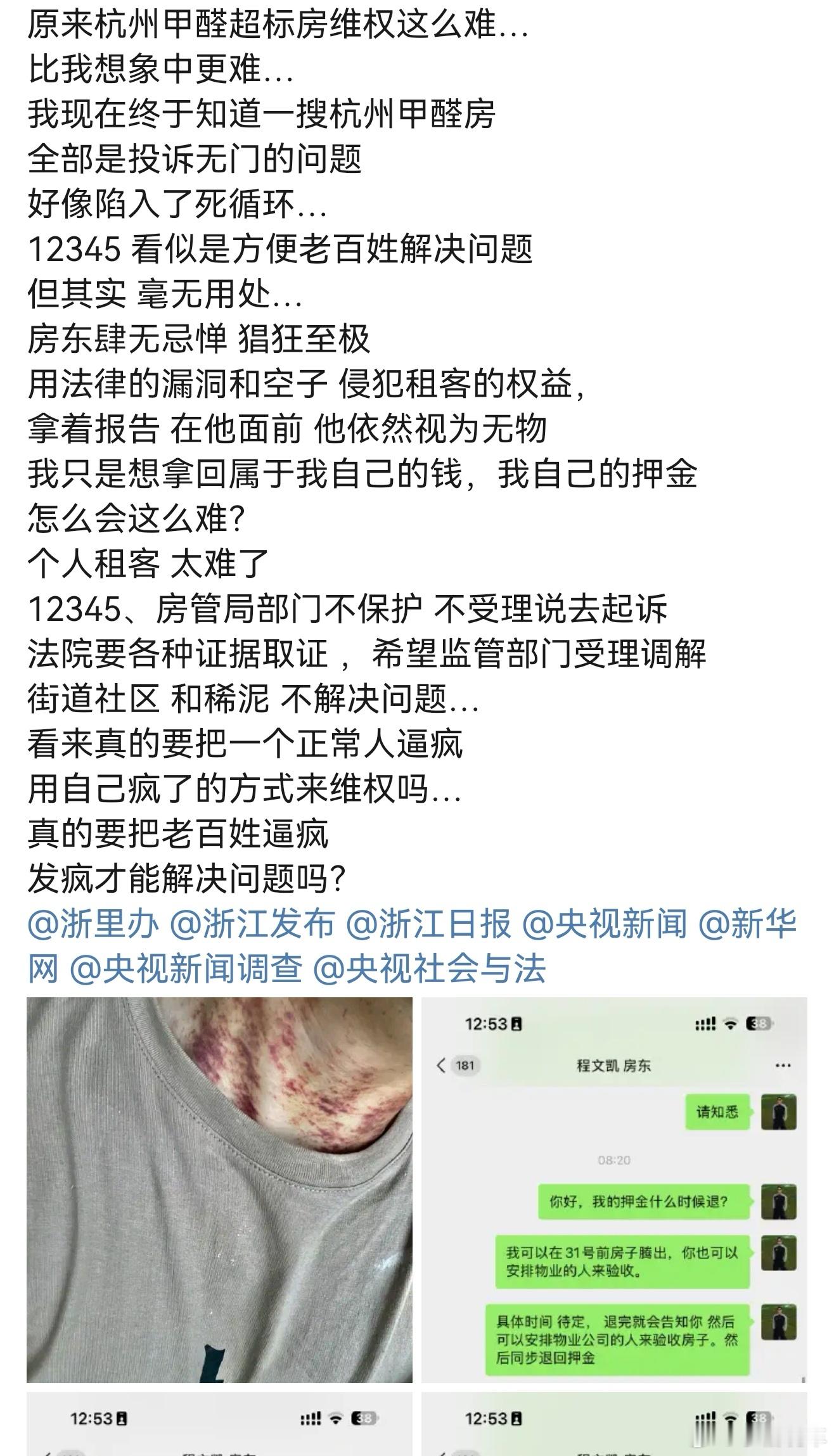 月租6万元甲醛房致患病房东发声不良房东真的太多了，月租六万押金肯定也多，甲醛患病