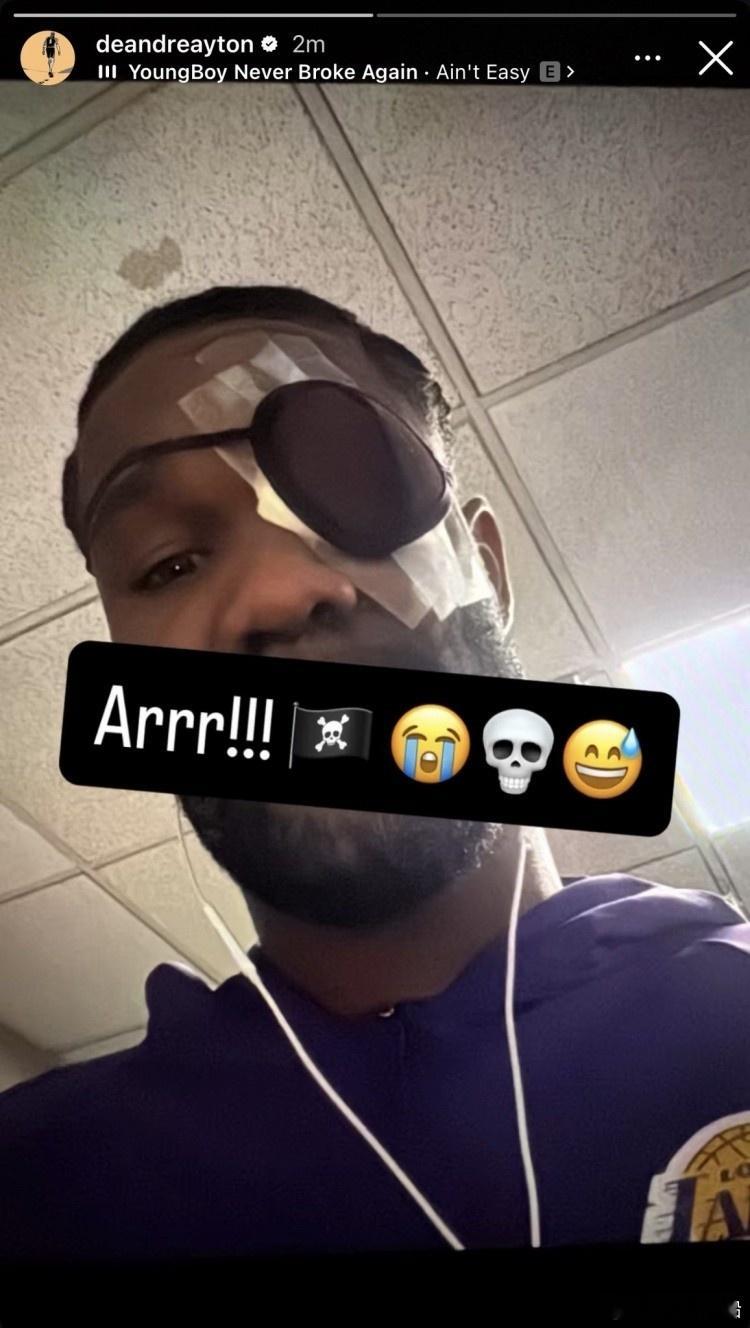 湖人更新了球队的伤病报告，艾顿￼的名字并没有出现在伤病报告中，明天可以出战！他在