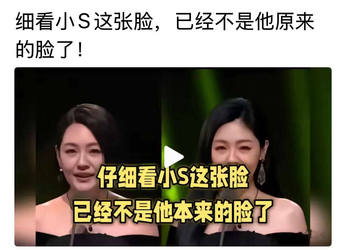 小S很久不见了，现在看到她的脸和之前有点不一样了。不像曾经的她了，毕竟经历了太多