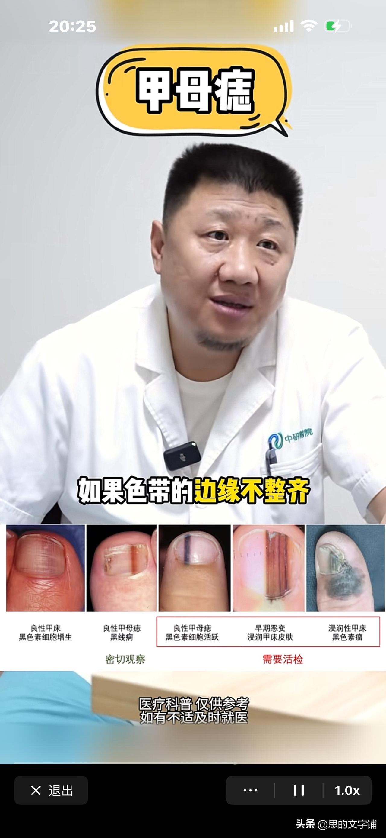太好了，DeepSeek上线了“识图模式”！
刚传了一个指甲黑线的照片，
问它要