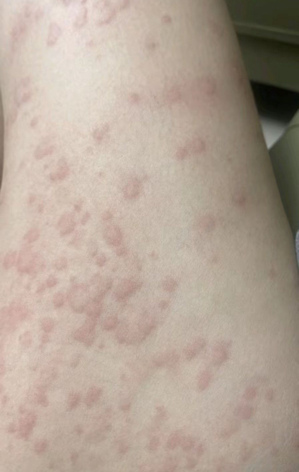 懂得都懂滚鸡蛋每次2-3个至少坚持滚15天就说这么多[挖鼻][挖鼻][挖鼻] ​
