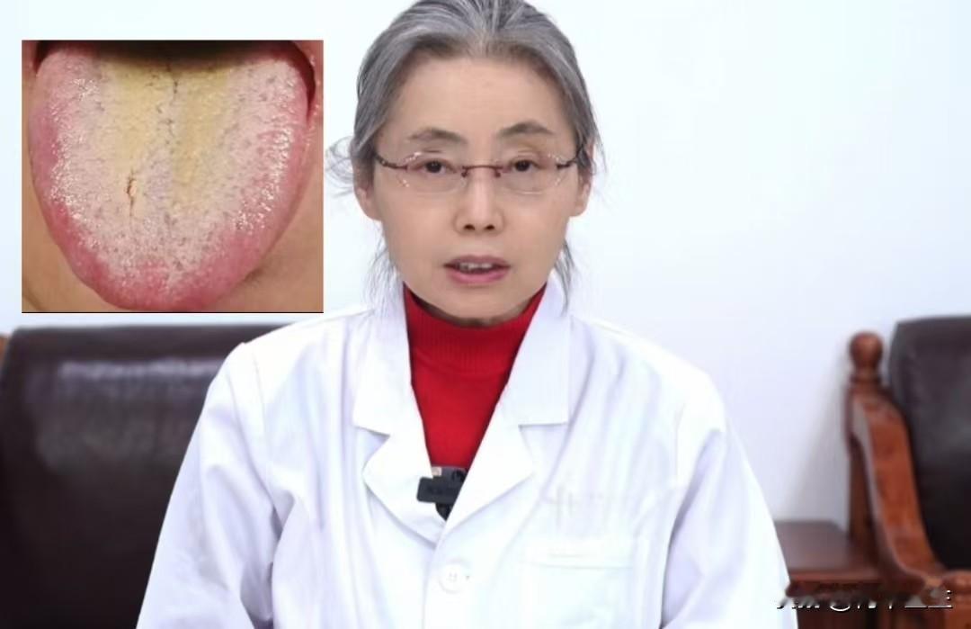 舌苔厚腻，脾胃虚弱，中医教你有效清理

正常情况下，我们舌头上都有一层薄薄的白苔