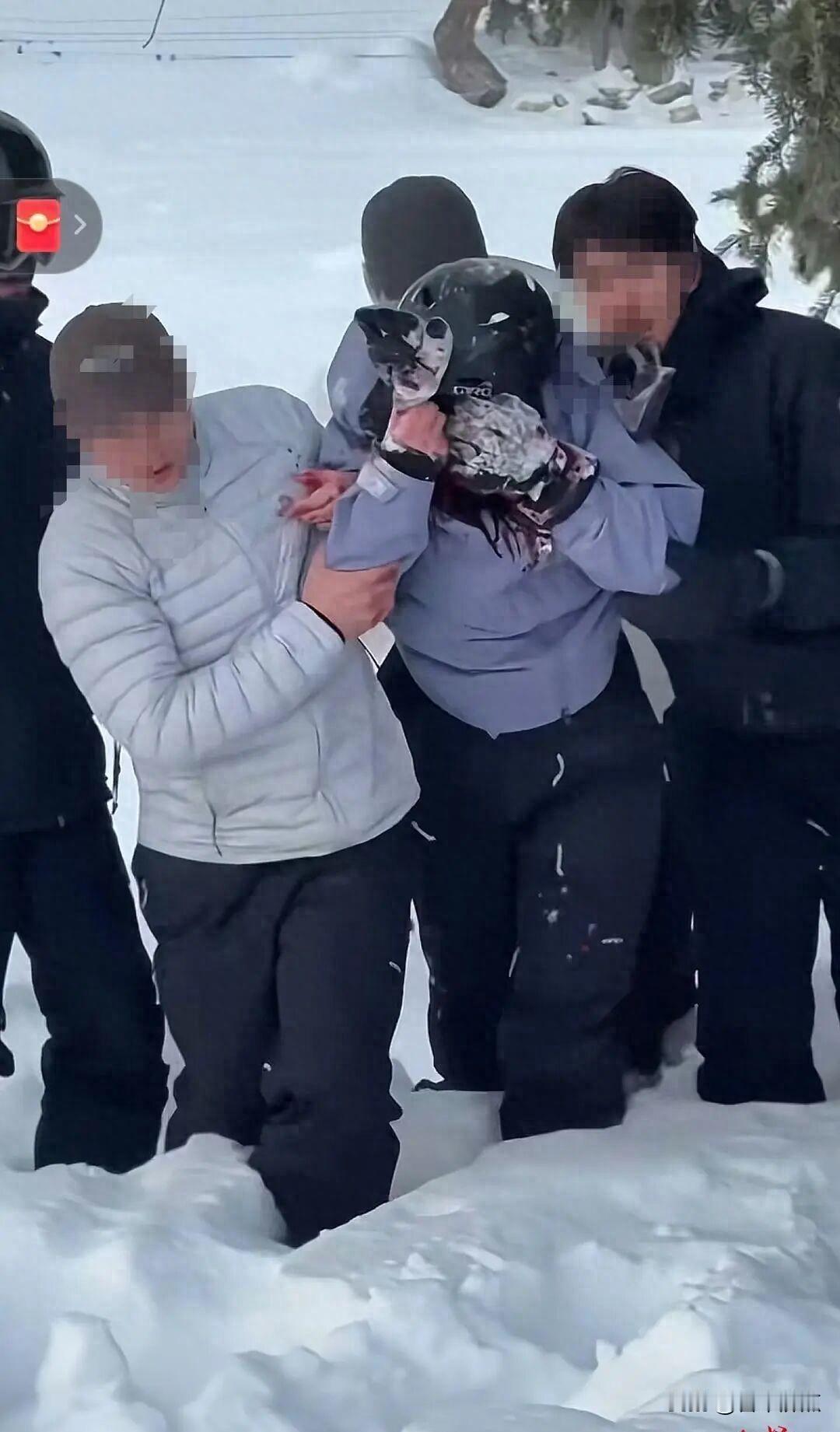 雪豹闯进羊圈咬死35只羊，游客刚被咬伤五天，它又来了。
这几天真挺吓人的。1月2