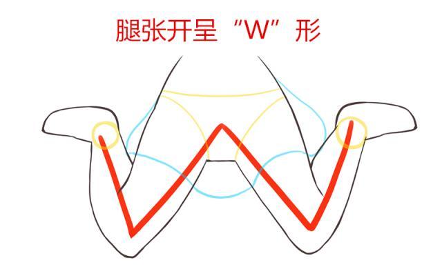 如果家里的宝宝喜欢“W”，家长要注意喽，这种坐姿对宝宝的危害可不小，要及时纠正。