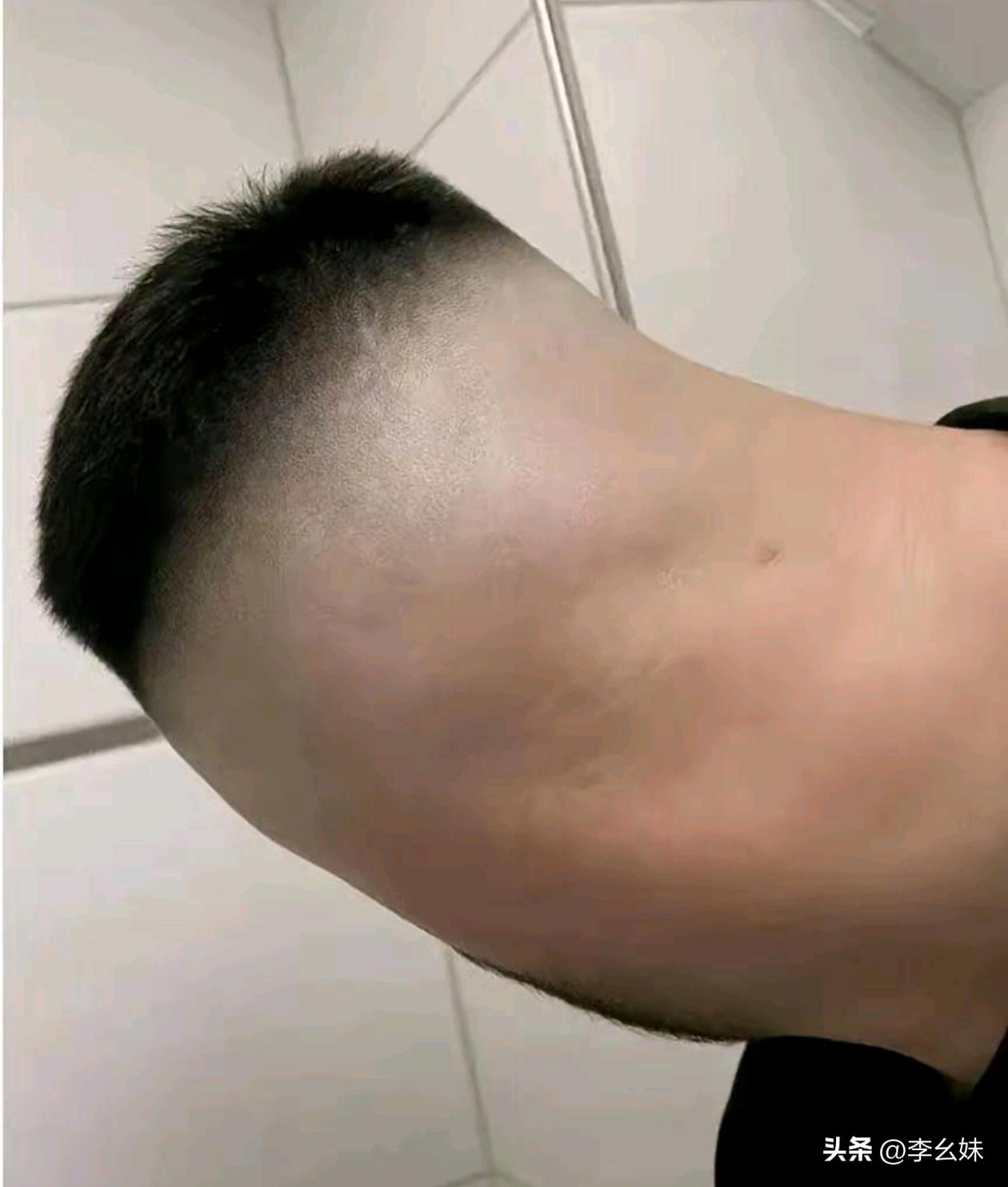 第一眼直接看懵！这真的是脖子吗？我怀疑我眼睛出问题了