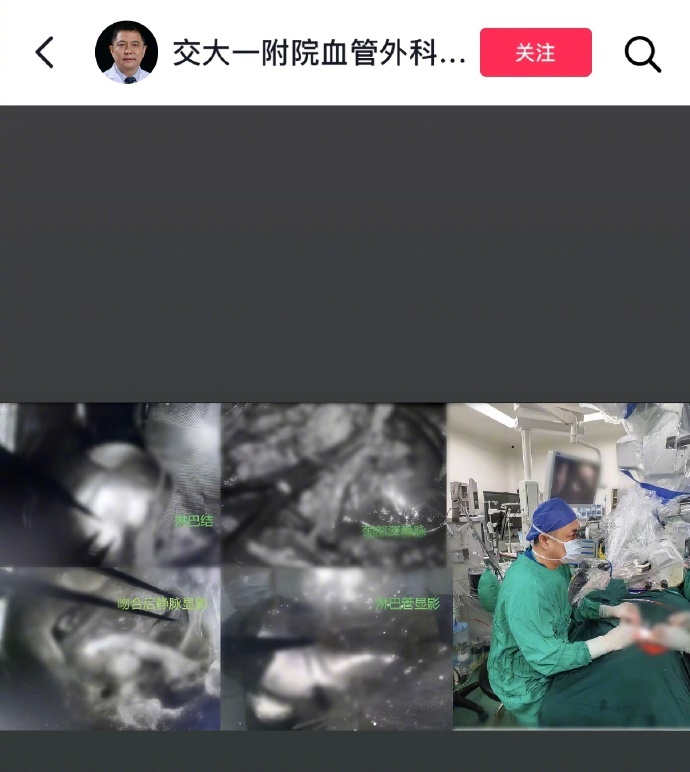 阿兹海默症可以做手术了？ ​​​