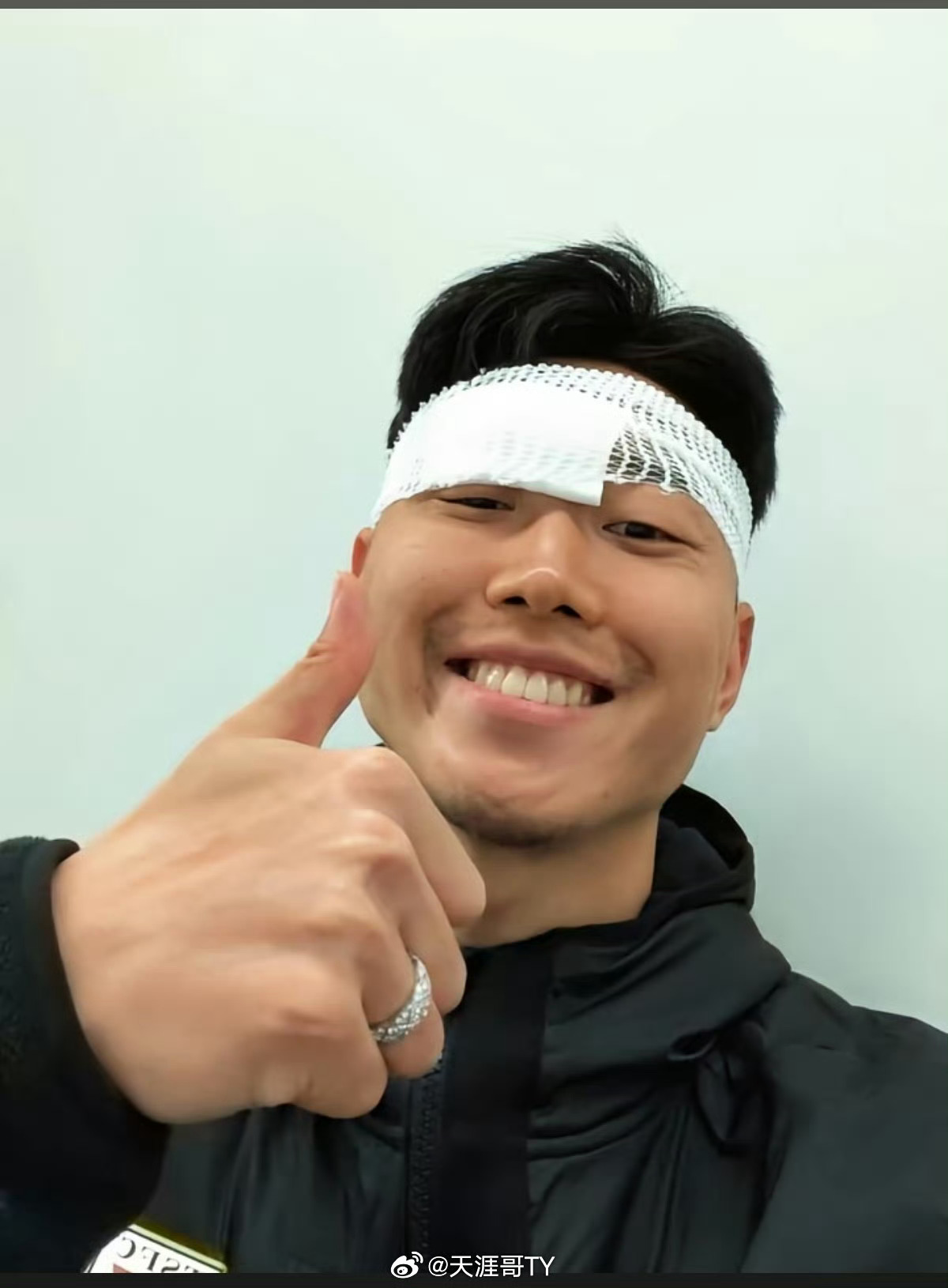 高准翼山东泰山vs北京国安 赛前发布会宿茂臻：高准翼头碰头血洒赛场，给我们的零封