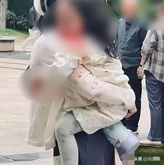 谁看了不愤怒！四川烈性犬失控伤人，两岁女童重伤进ICU，代价太惨痛！
 
9月1