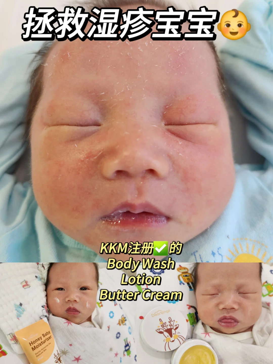 湿疹宝宝的沐浴露＆身体乳 Eczema Baby
