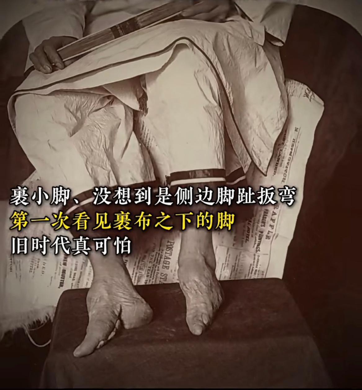老照片：旧时代的裹小脚，看上去真是触目惊心，让人有些心理不适[允悲]