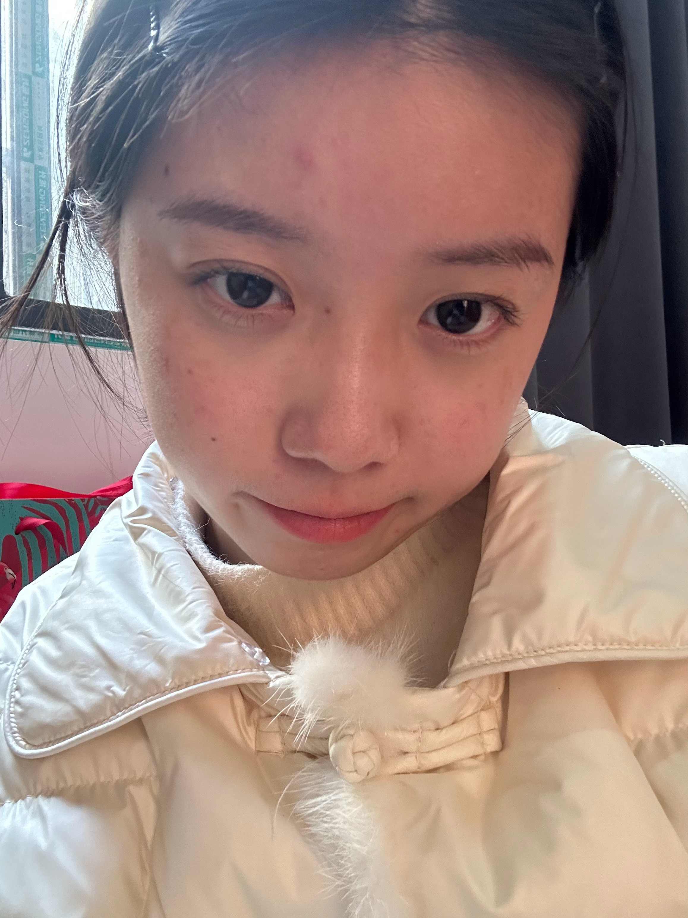我奶问我额头上在哪儿撞了个包 