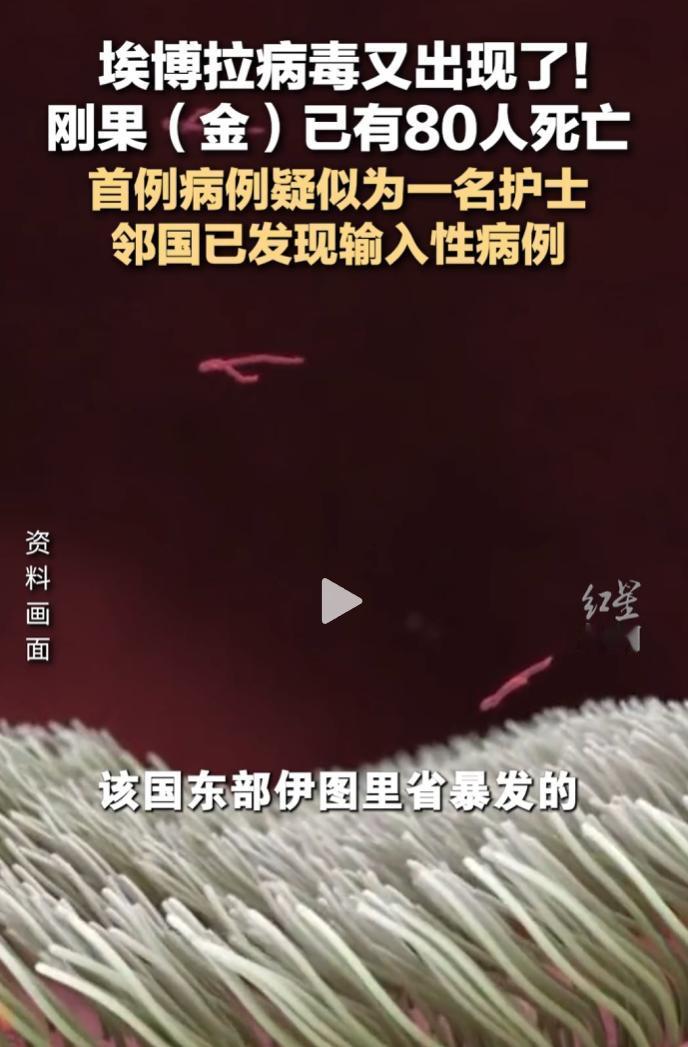 埃博拉病毒卷土重来，刚果（金）已有80人死于本轮疫情。
 
疑似首例为一名护士，