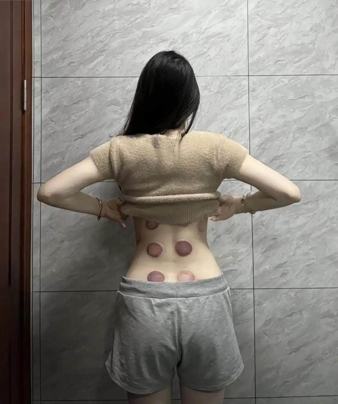 今天去拔罐的经历让我感觉有些不好意思。
一走进中医馆，
就看到不少人在排队等着做