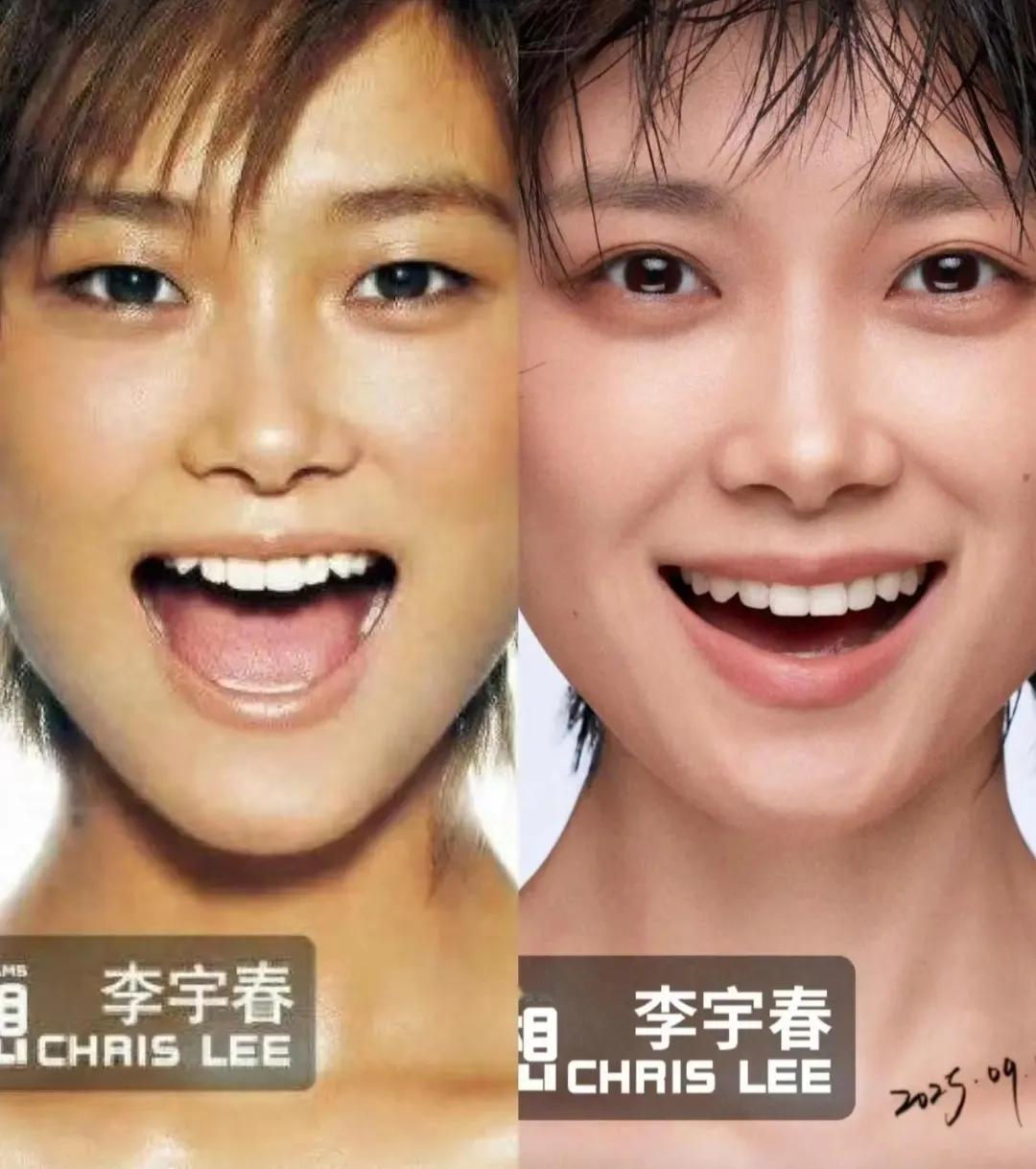 她后期怎么变双了？应该是长开了吧，感觉也多了份成熟！