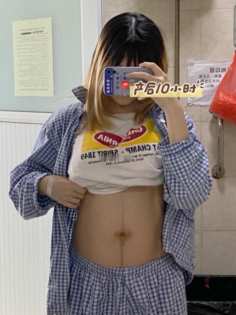 产前96斤 有马甲线产后10小时从120斤掉到110斤产后10天掉完水分先瘦腿产