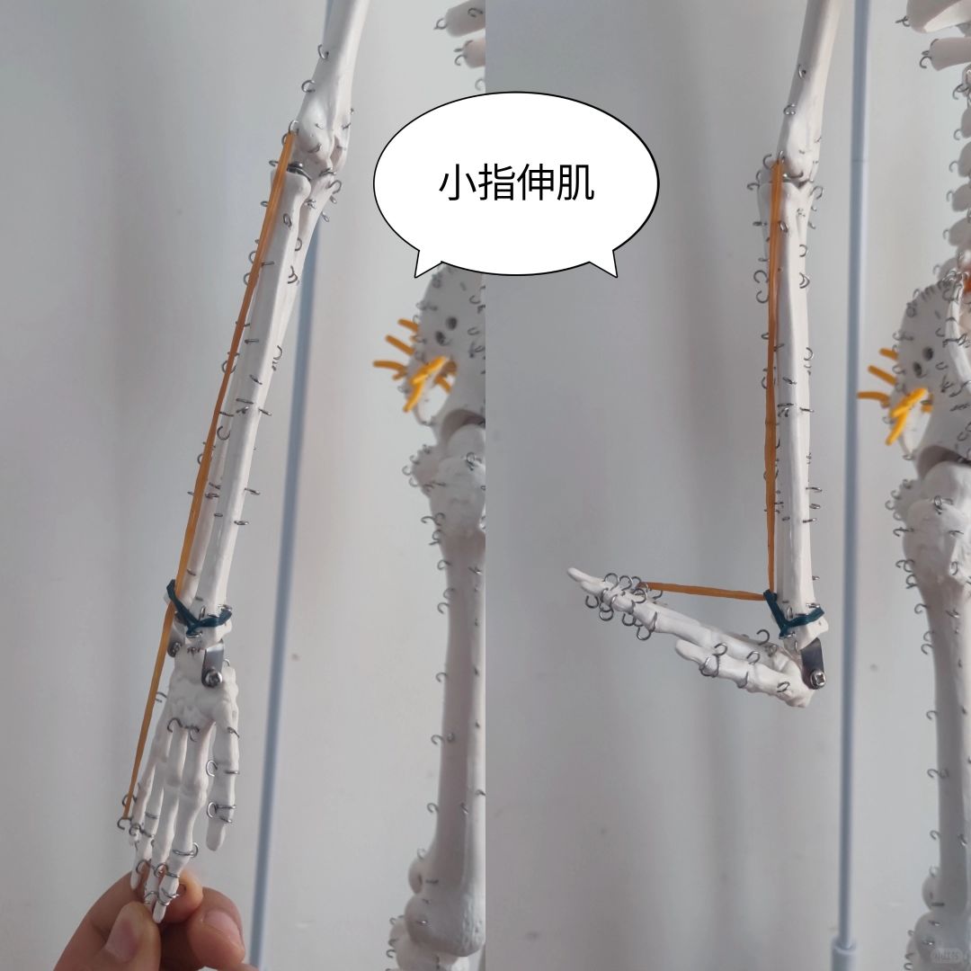 小指伸肌