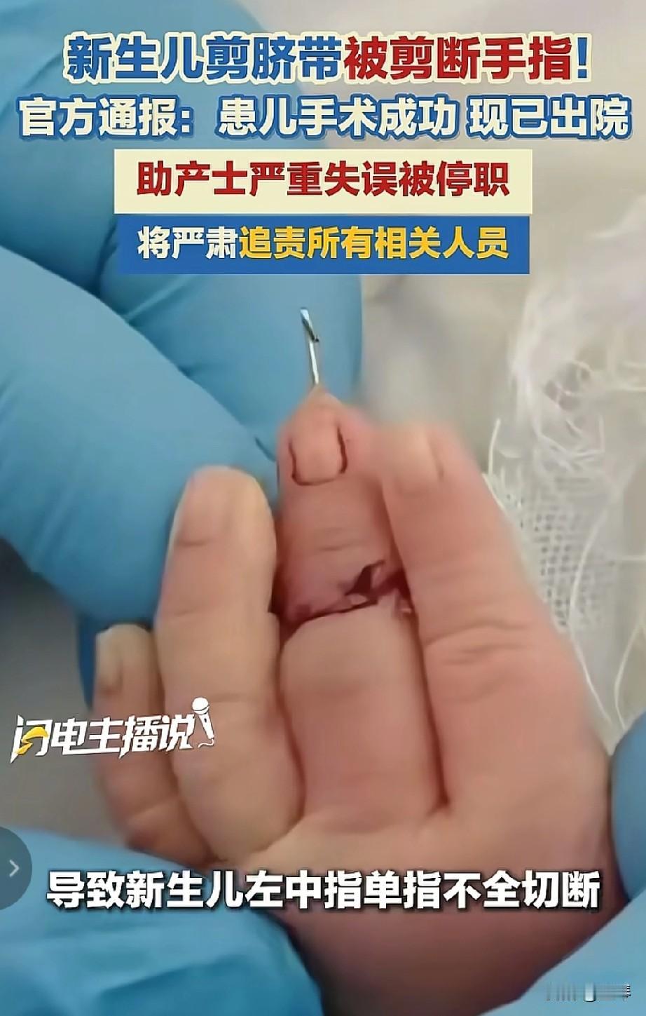 江苏盱眙新生儿剪脐带被剪断手指，助产护士已被停职，新生命的伤害该谁来弥补？
 