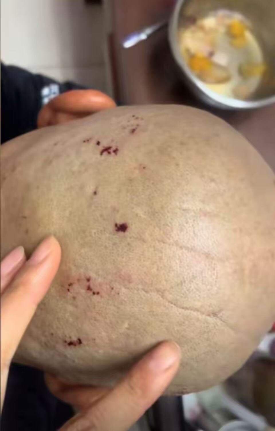 天津，大爷花10元剃头，结果被剃的满头伤口！女儿想要去讨个说法，大爷却不忍追责，