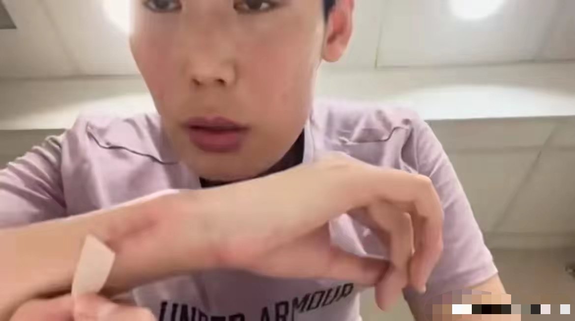 被朱婷给整破防了！出发杭州前，朱婷在社交媒体平台，发布了一条关于手腕动完手术后康
