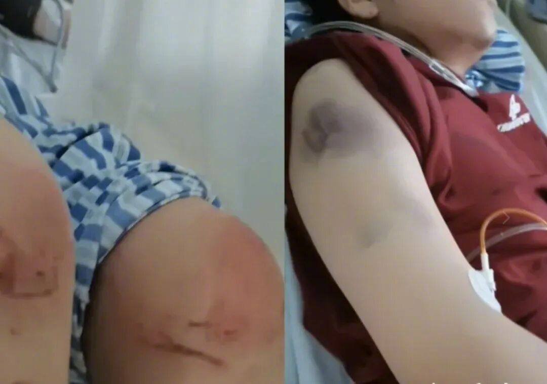 女子遭殴打驾车致丈夫身亡维持原判热点解读 这起案件将两个社会高度敏感的问题叠加：