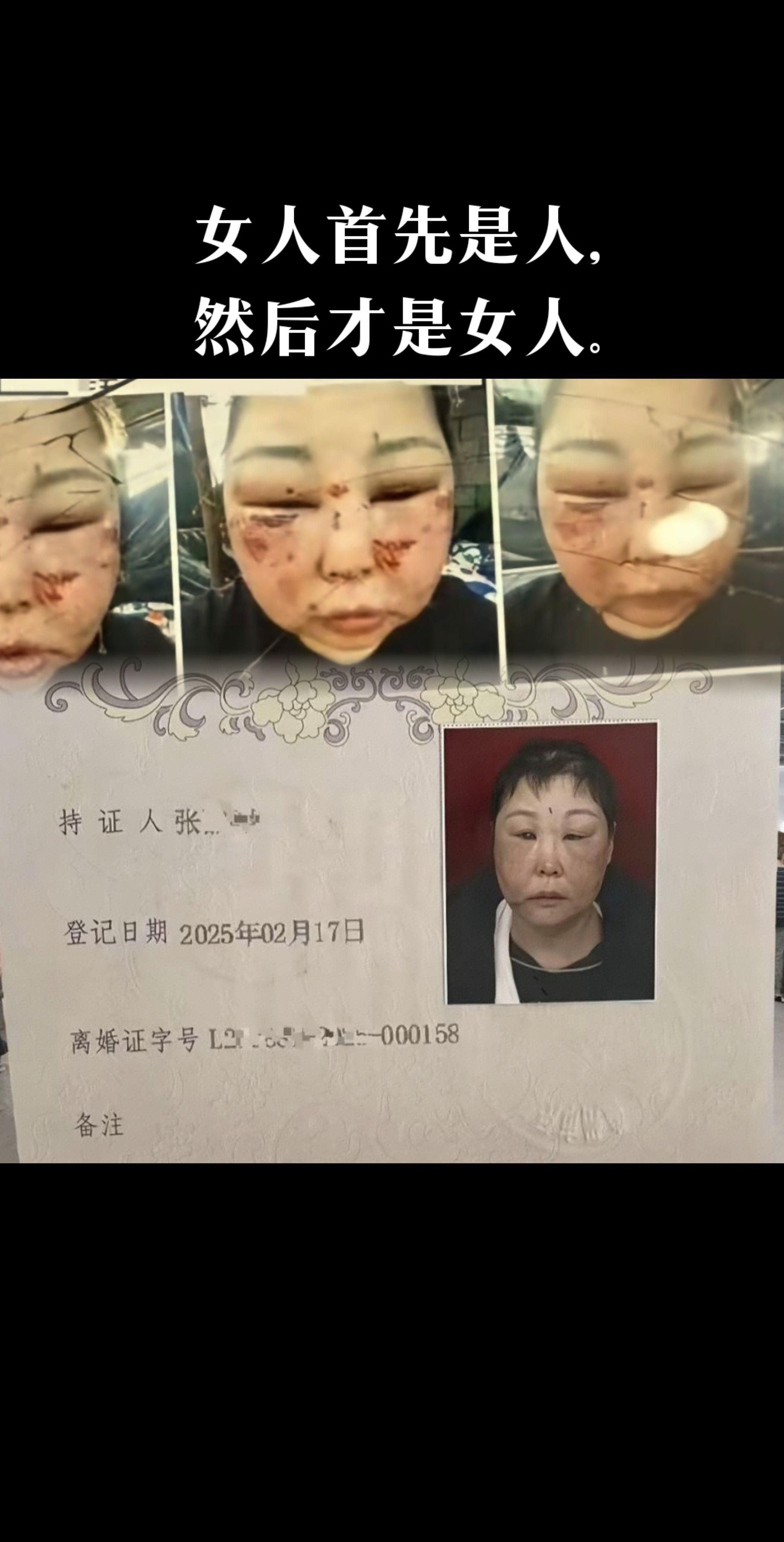 43岁女子被前夫殴打肠破裂昨夜离世。连离婚证照片上的脸部都肿胀变形。