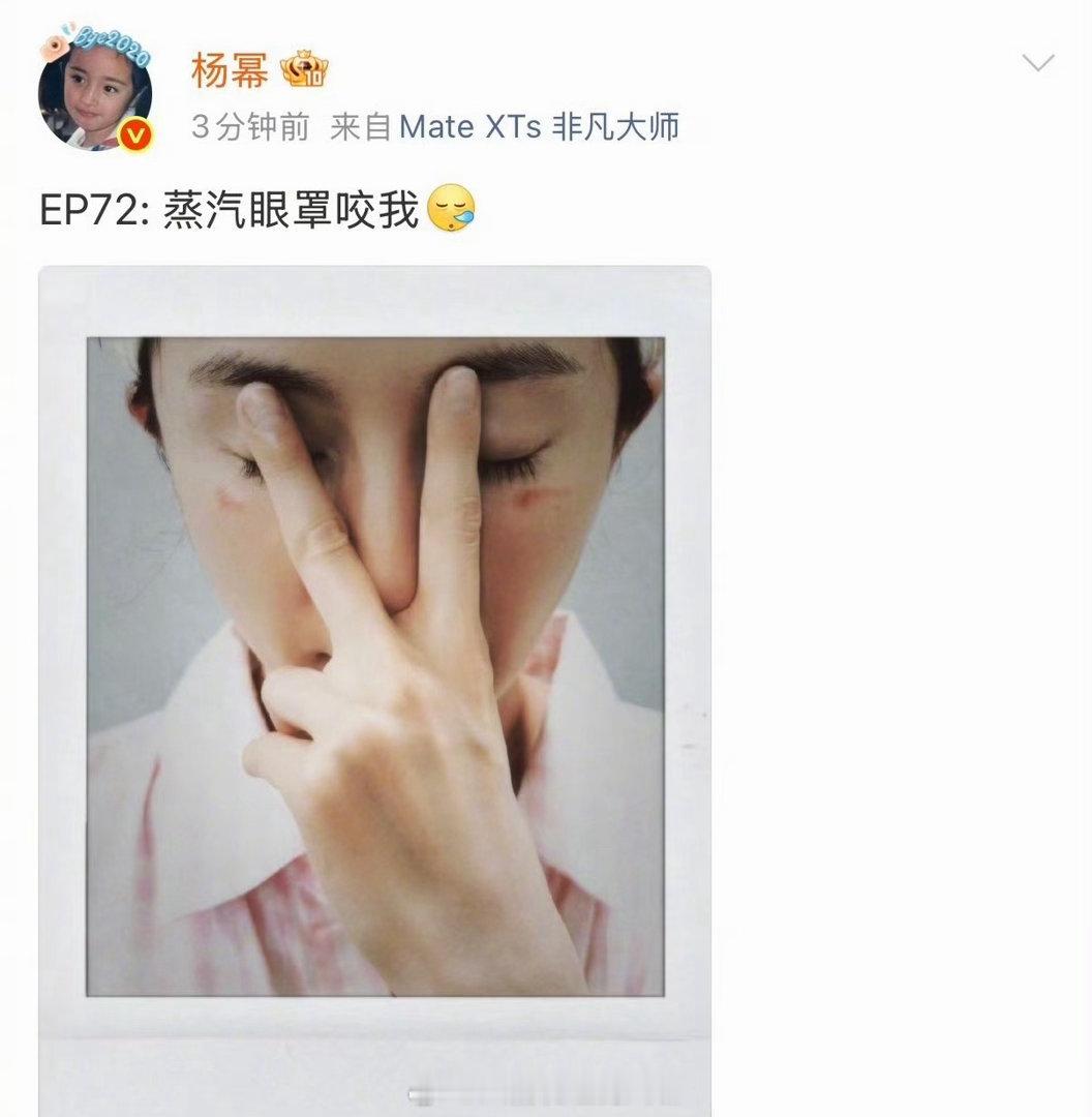 杨幂展示北魏太后妆杨幂回应被眼罩烫伤心疼杨幂了啊……