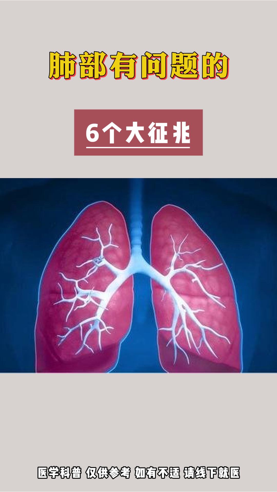 肺部有问题的六大征兆。