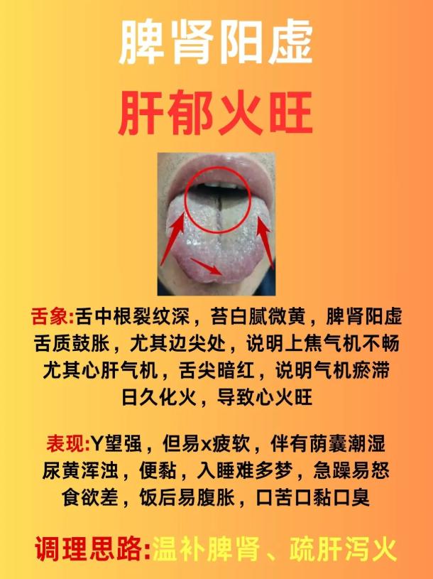 3 种常见复合体质舌象，对照自查，精准辨证