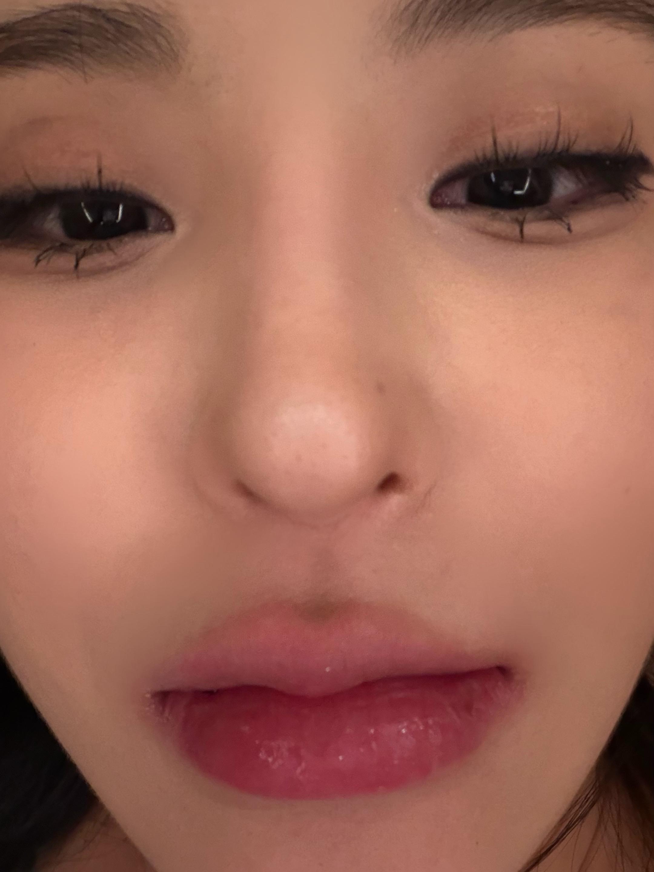 拔牙牙痛吃啥药啊 疼生气了