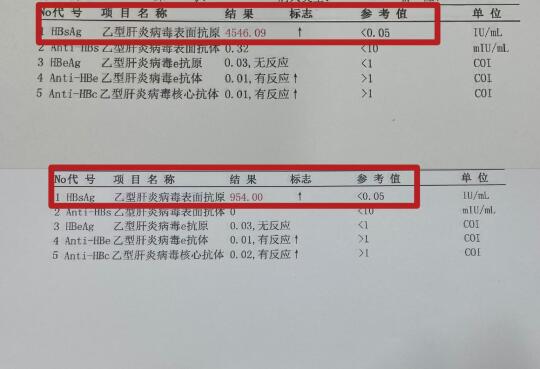 乙肝患者成功步入优势人群行列！20多岁小伙，表面抗原从4000+到小于...