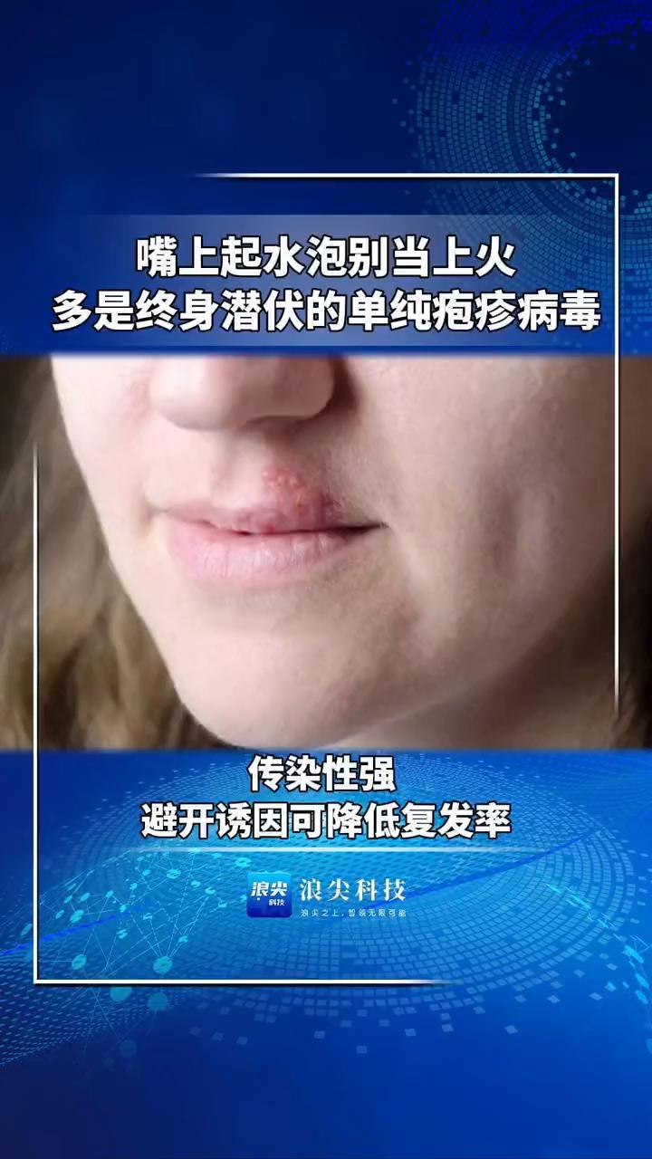 嘴上起水泡别当上火，多是终身潜伏的单纯疱疹病毒。
浪尖科技。
传染性强，避开诱因