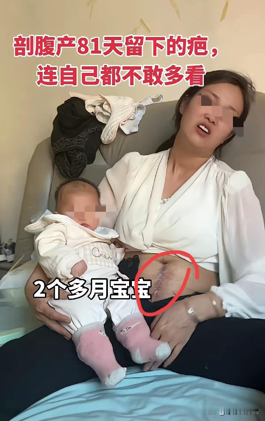 很多人以为，生孩子无非就是疼一阵子，宝宝落地就万事大吉。
可只有当过妈妈才懂，不