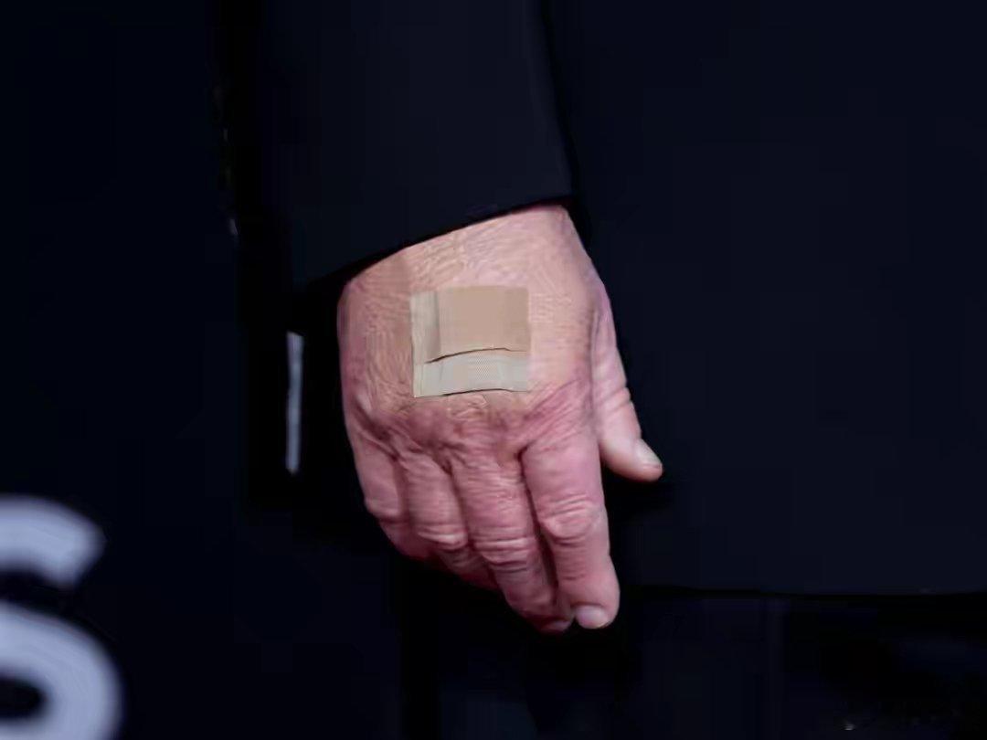 特朗普承认服用阿司匹林 懂王果然名不虚传！医生建议的低剂量嫌不够，每天325毫克