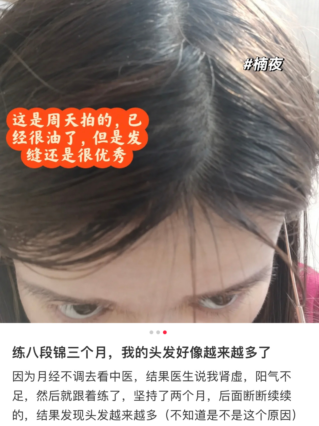 真的建议女生练八段锦 ​​​