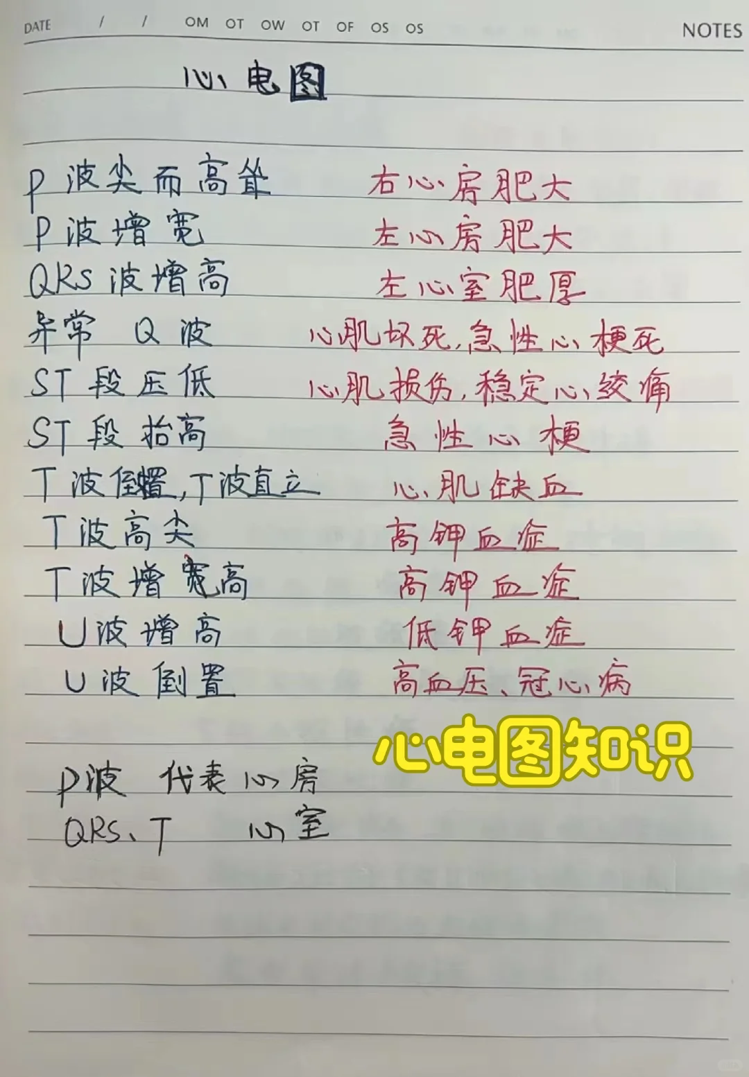 各种常见心电图速记