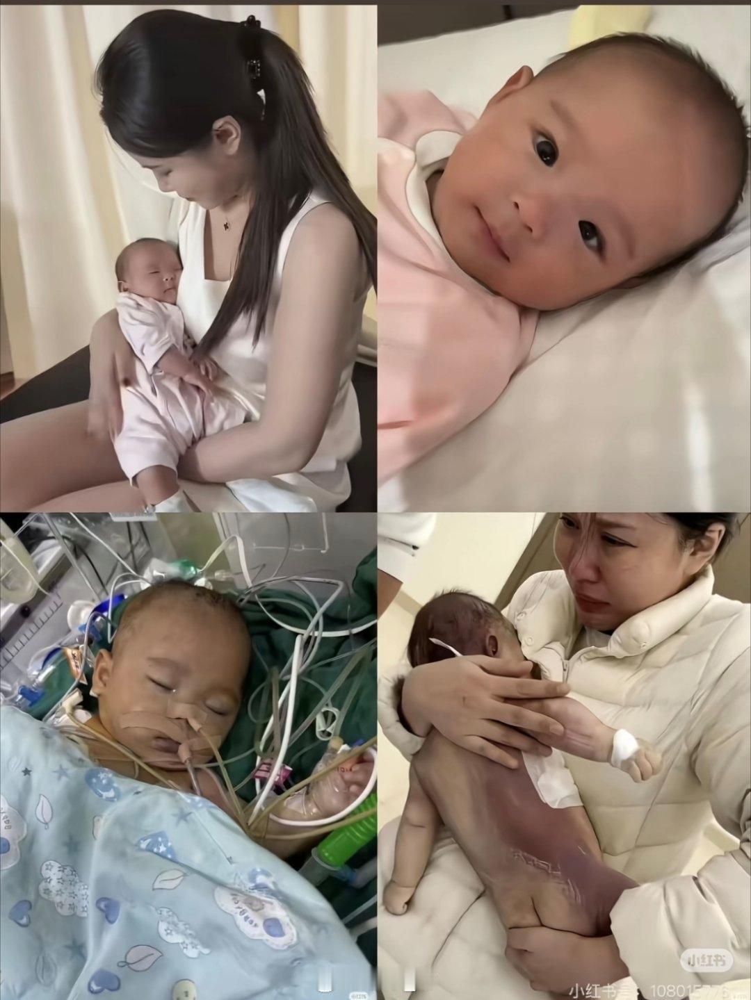 5个月大的早产女婴许洛熙，本应在父母怀里撒娇，却因“静脉窦型房间隔缺损”被推进手