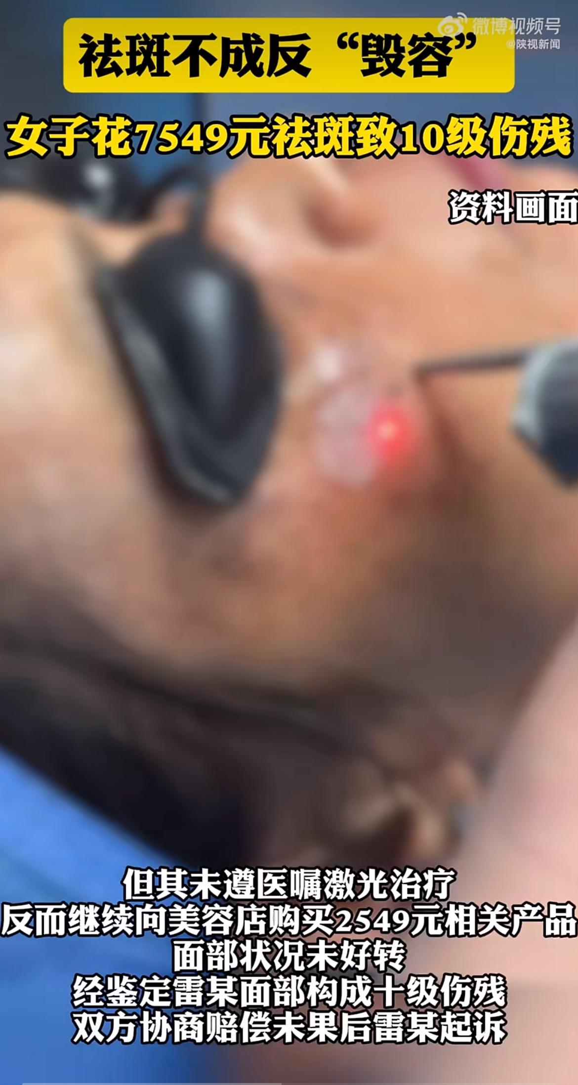 “这到底是美容还是毁容？”女子花7549元祛斑，结果脸毁了还落下10级伤残！法院