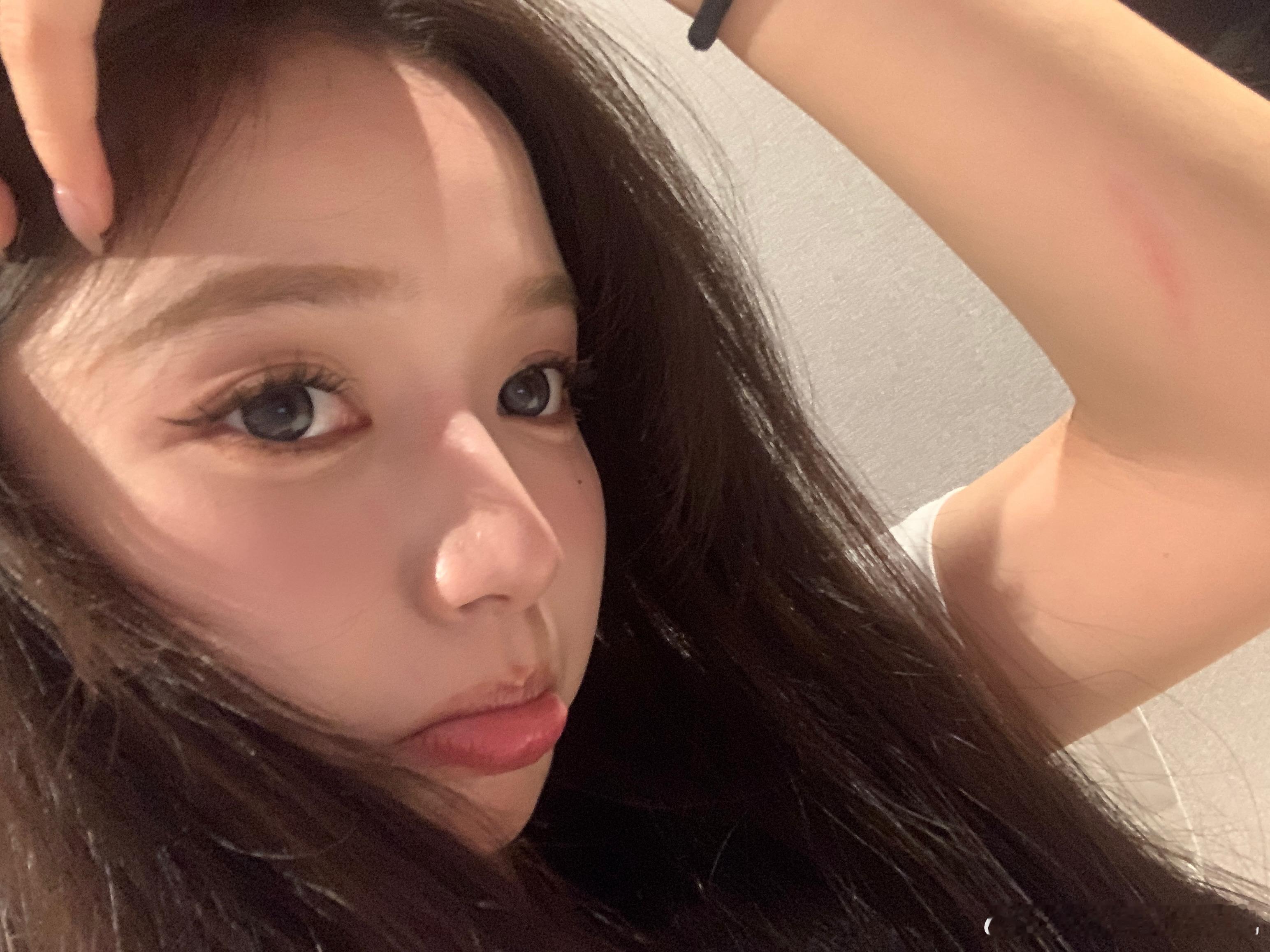 为什么总是不小心[苦涩]我这个疤痕体质这种小伤还都会留色印的人 ​​​