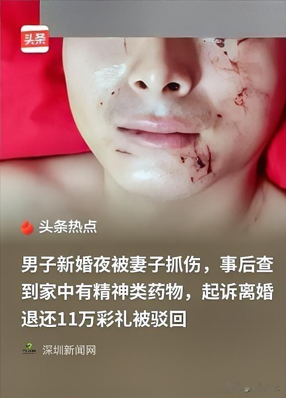 索回11万彩礼遭驳回 新婚夜抓花脸与精神分裂药争议

新婚夜，本该甜蜜，却闹到抓
