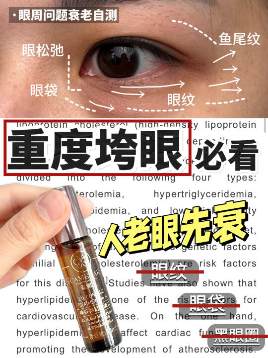 眼周抗老内科学途径！一片搞清楚老化机制