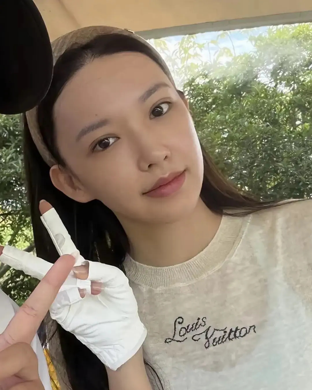 程潇这个双眼皮也太恐怖了吧