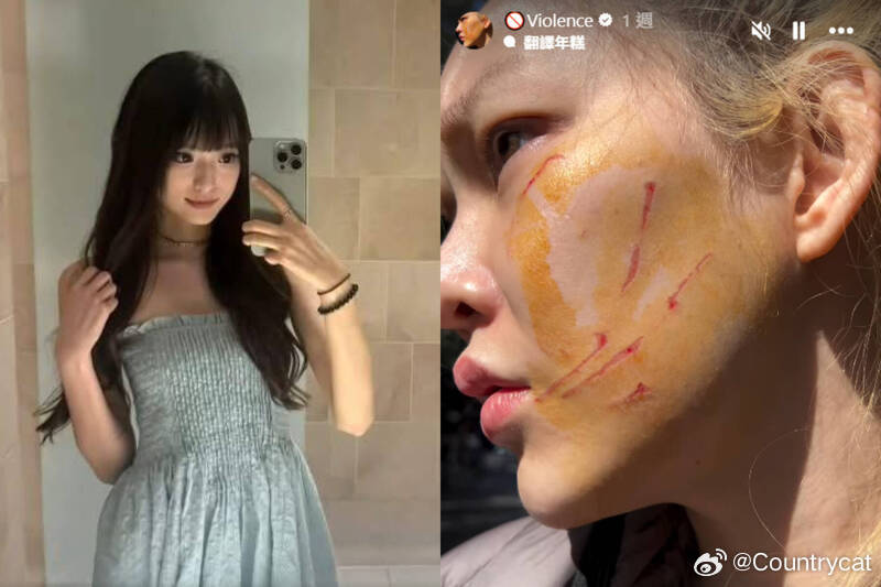 【泰国网红悉尼遭中国女子暴打 脸部受伤险被热汤泼伤】海外新鲜事 泰国网红Babb