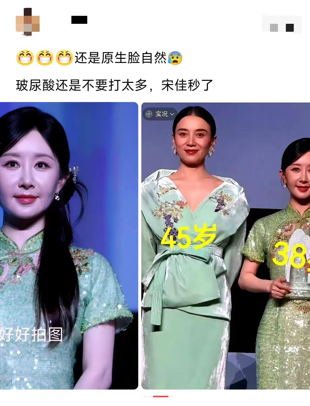 45岁宋佳真的赢麻了
