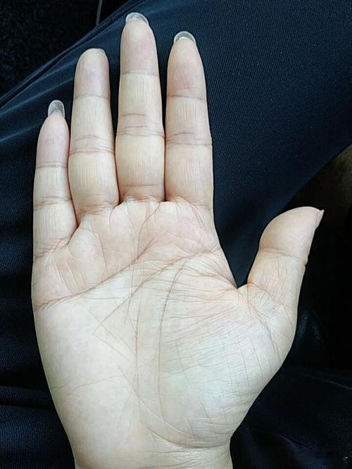 大器晚成的手；事业线中间断开，但旁边又有一条小线往上走，代表35岁之前会经历一次