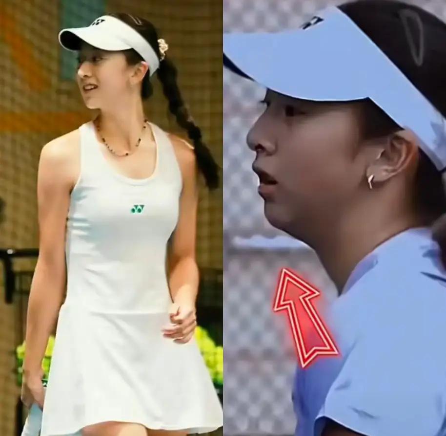 贫穷限制了我的想象，

以前以为医美顶多整个鼻子、割个双眼皮，直到看到田亮女儿森