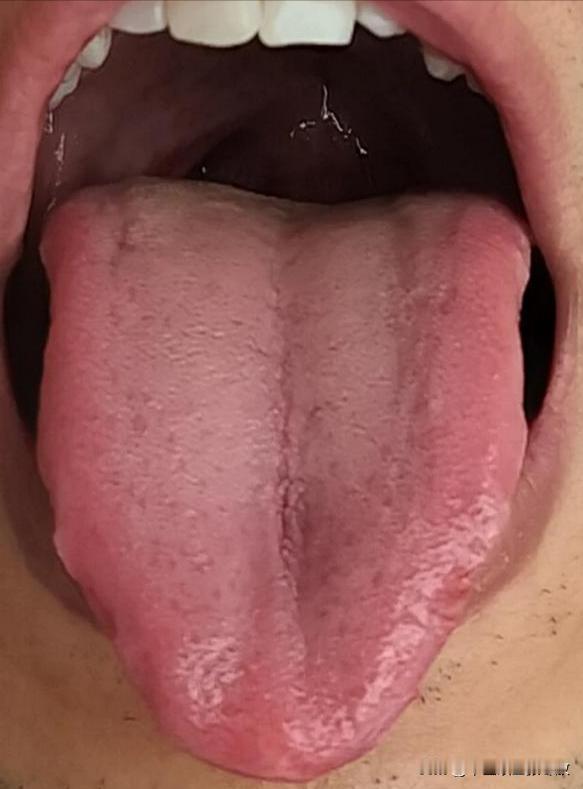 天天失眠，心里想那么多，还不好好节制，身体能不虚吗？[抠鼻][抠鼻]
主诉：天天