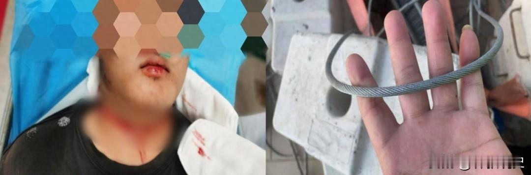 高空惊魂！钢丝绳突然断裂，18岁工人被“绞喉”30秒。[嘘]

一根突然断裂的钢