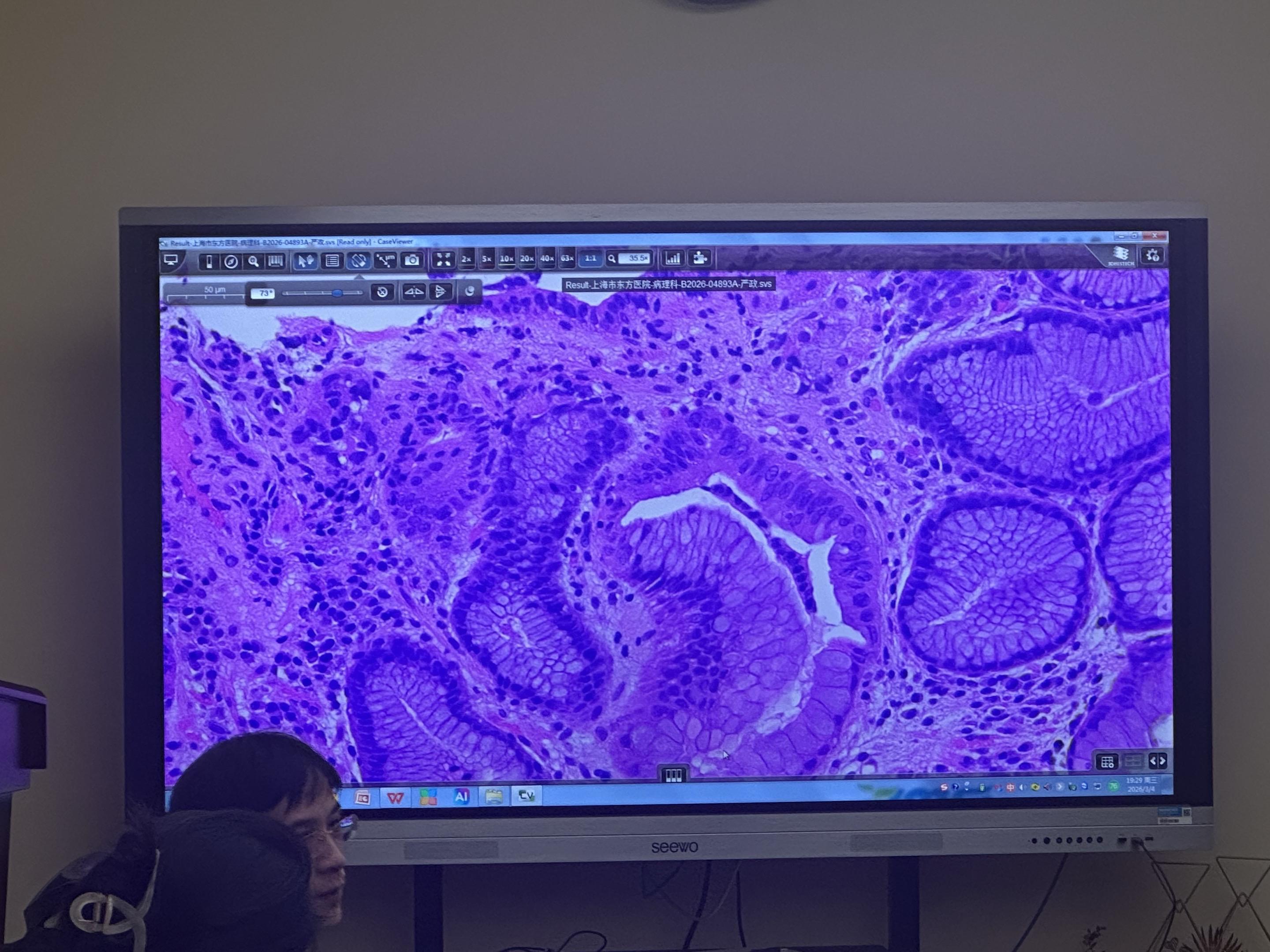 学习使我快乐…… 天花板的水平是不断卷出来的，每一个动作，每一个习惯都...