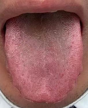 辨证虚实调脏腑，循序养回元气状态





中医对于隐疾问题的调理务必要辨证论治