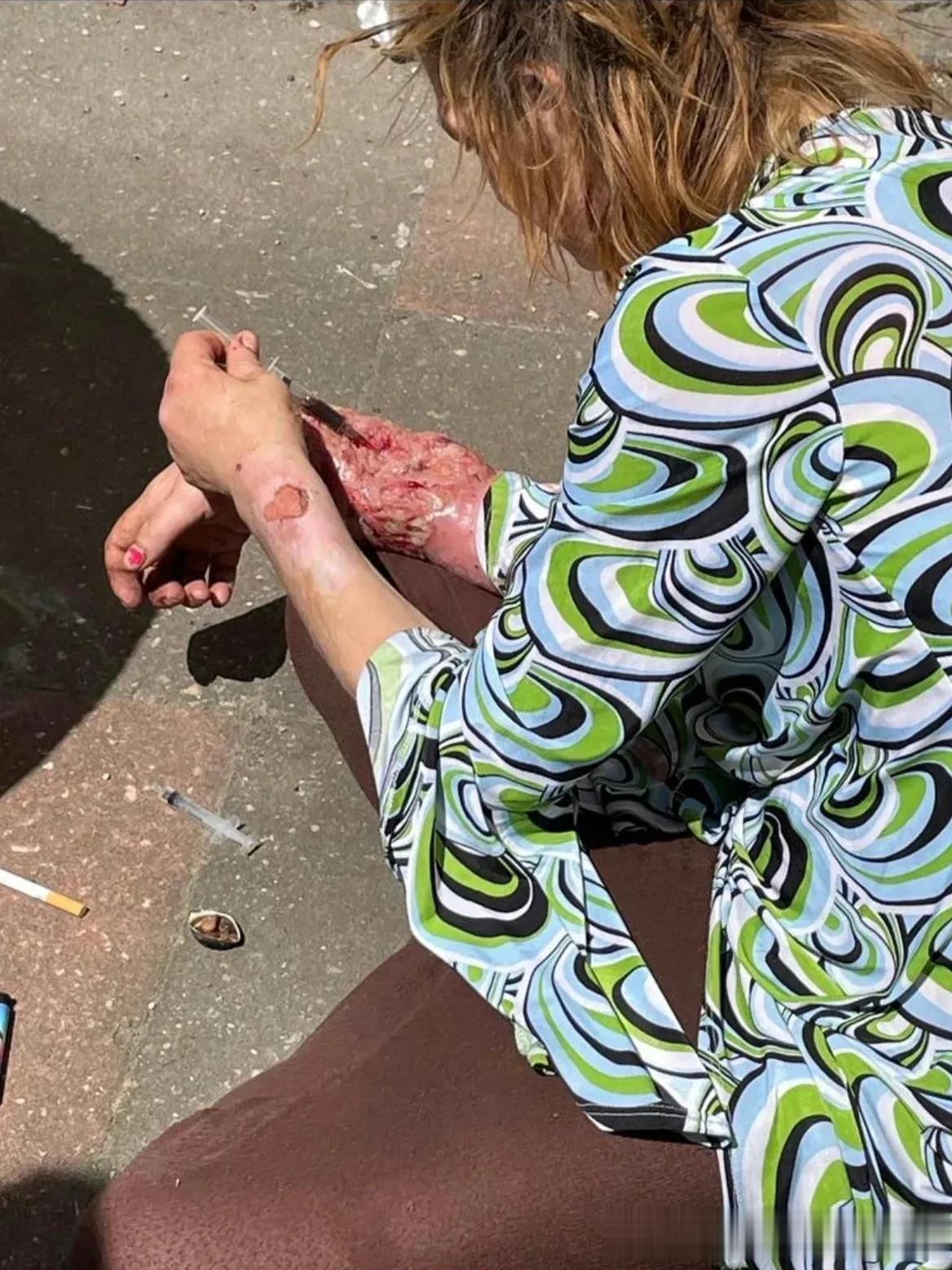 昨天德国媒体的曝光，散落在柏林街头的瘾君子们，
都烂肉一堆了，看看都可怕。
有外
